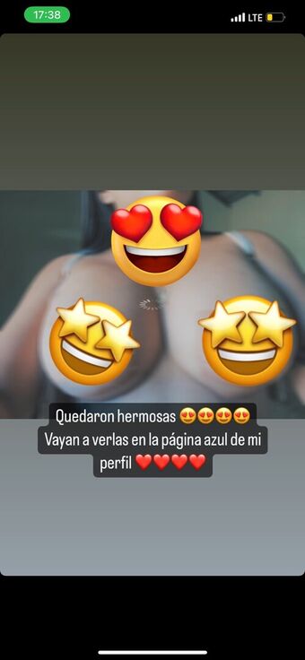 Abbyperlera Nude Leaks OnlyFans Photo 3