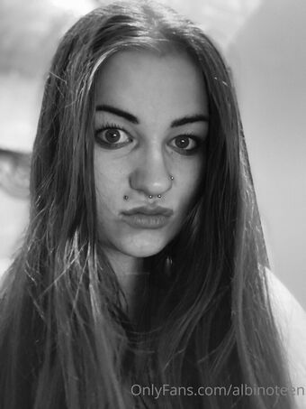 Albinoteen