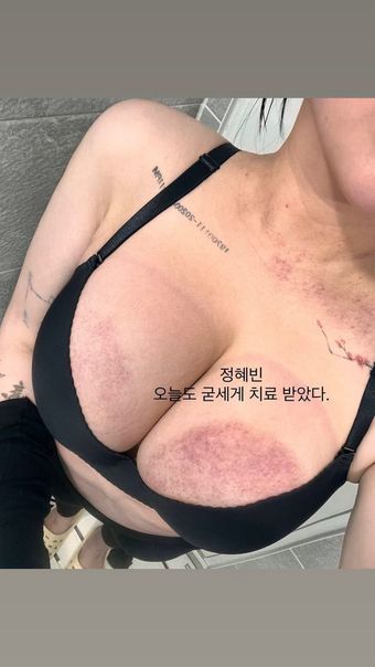 Jung Hye Bin Nude Leaks OnlyFans Photo 11