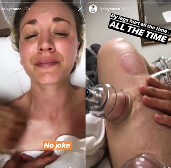 kaleycuoco Nude Leaks OnlyFans Photo 10