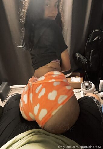 spottedhottie21