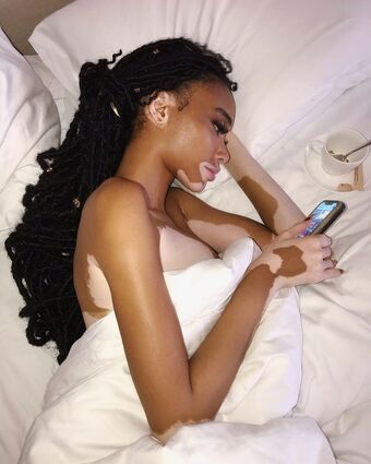 Winnie Harlow